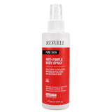 REVUELE 150ML ANTI-PIMPLE B/SPRAY